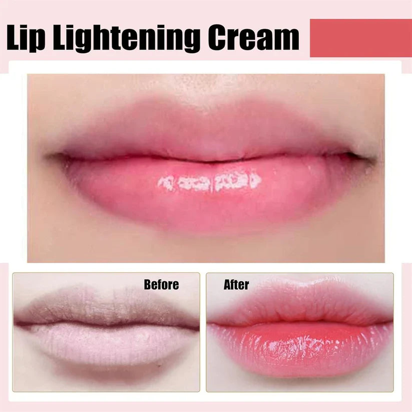 Lip Lightening Cream – Moisturizing, Brightening & Nourishing Cream