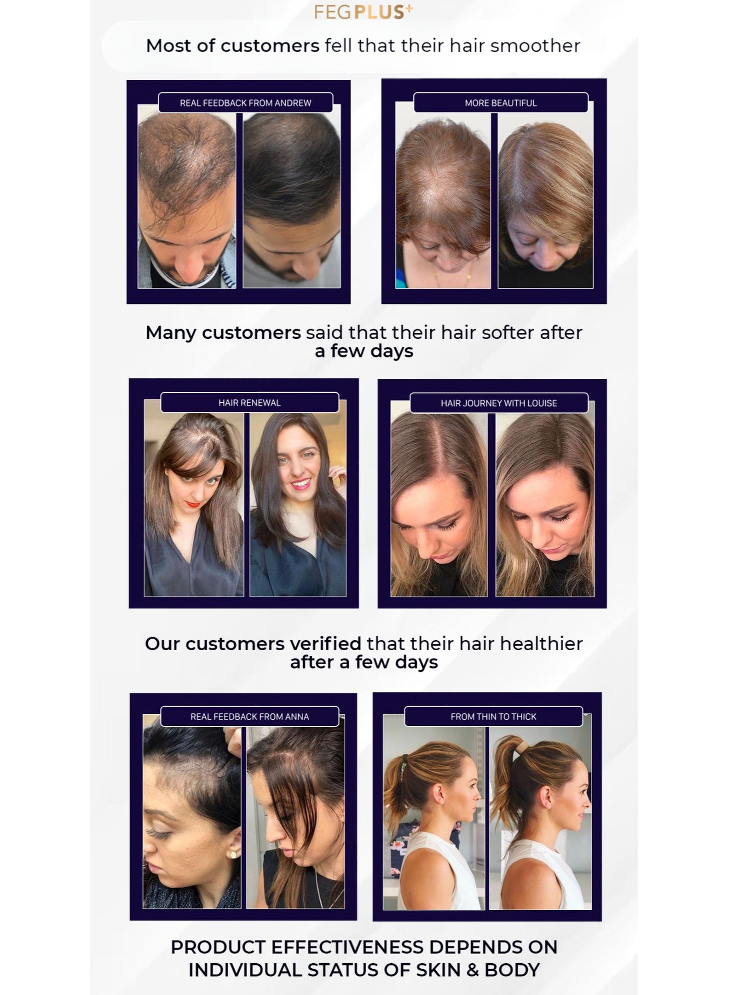 FEGPLUS Hair Growth Serum 50ml