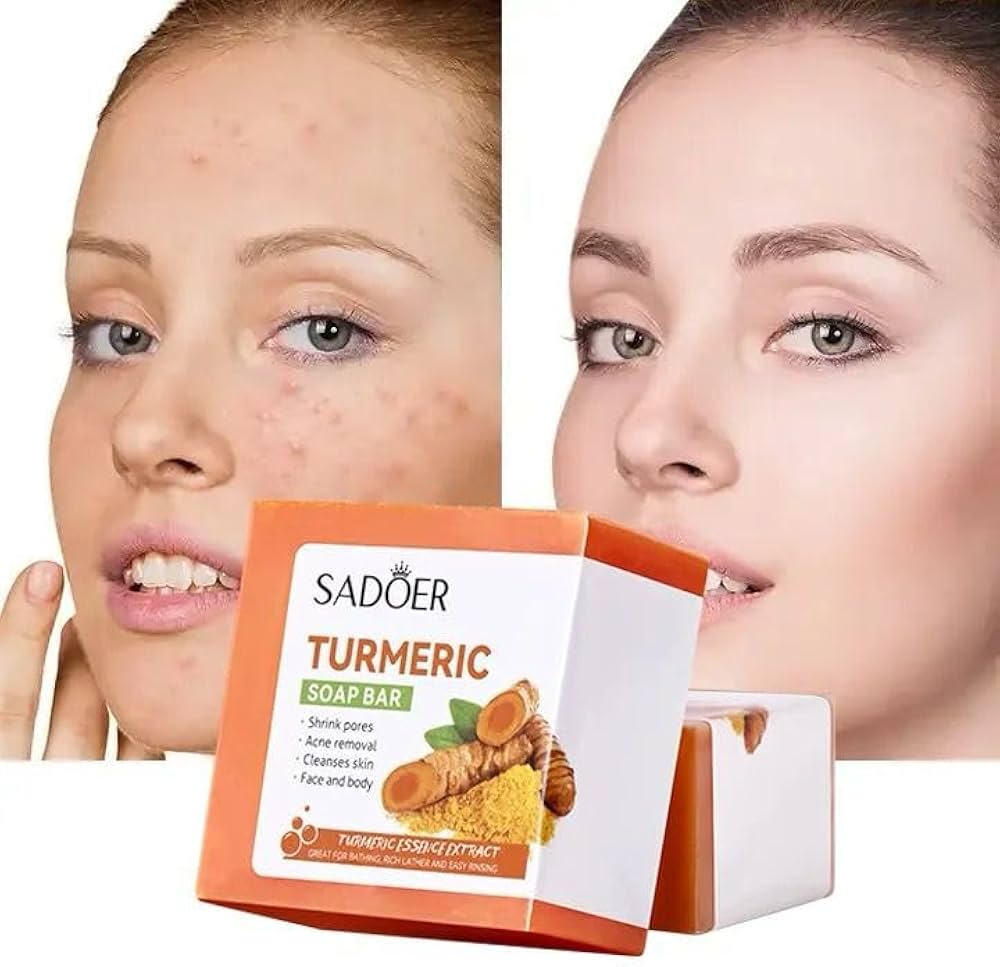 Turmeric Kojic Acid Soap Whitening & Brightening ( BUY 1 GET 1 FREE )