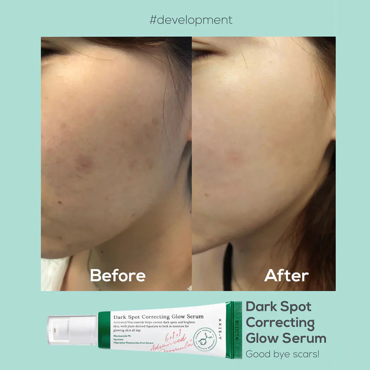 Dark Spot Correcting Glow Serum