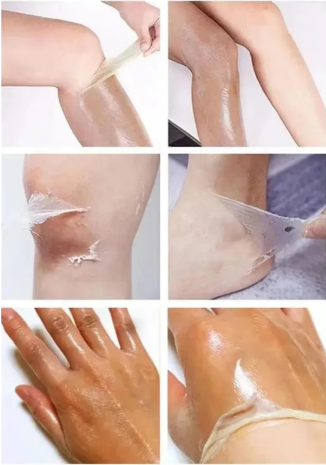Peeling Oil for Facial & Body Exfolianting - Dead Skin Remover with Gentle Formula for All Skin Type