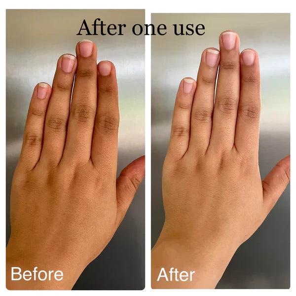 Dhiin Dhiin Multi-Area Dark Spot Remover – Smooth & Even Skin All Over