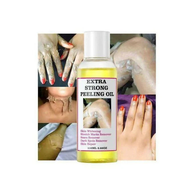 Peeling Oil for Facial & Body Exfolianting - Dead Skin Remover with Gentle Formula for All Skin Type
