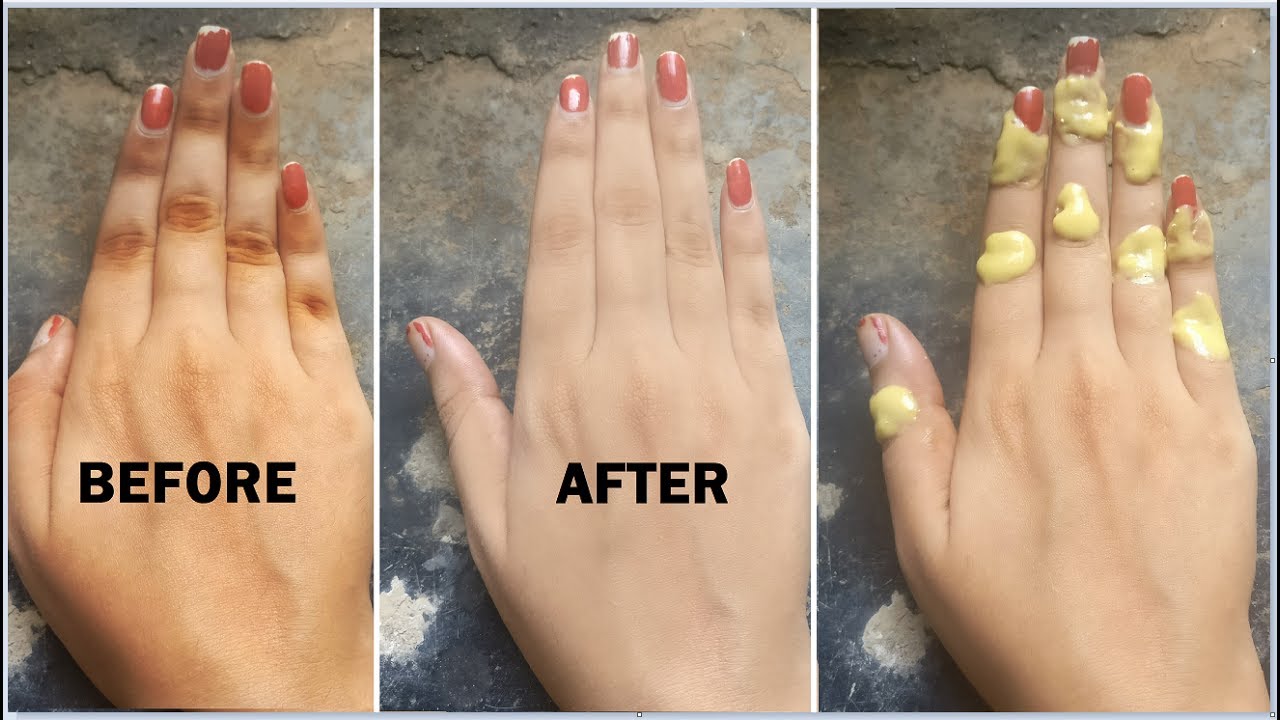 Dhiin Dhiin Multi-Area Dark Spot Remover – Smooth & Even Skin All Over