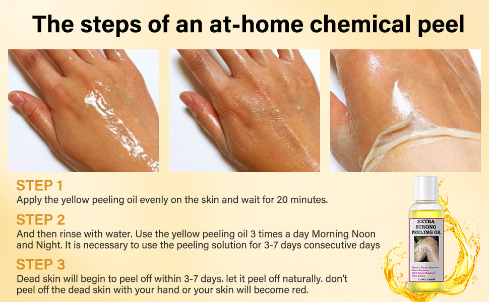 Peeling Oil for Facial & Body Exfolianting - Dead Skin Remover with Gentle Formula for All Skin Type