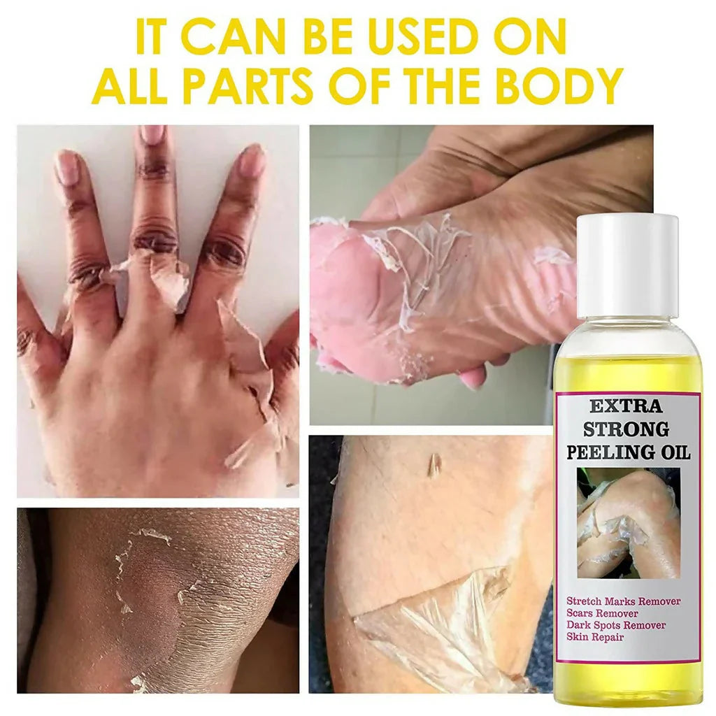 Peeling Oil for Facial & Body Exfolianting - Dead Skin Remover with Gentle Formula for All Skin Type