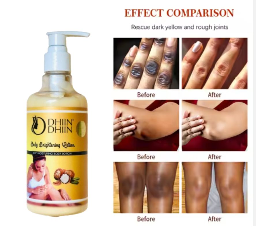 Dhiin Dhiin Multi-Area Dark Spot Remover – Smooth & Even Skin All Over
