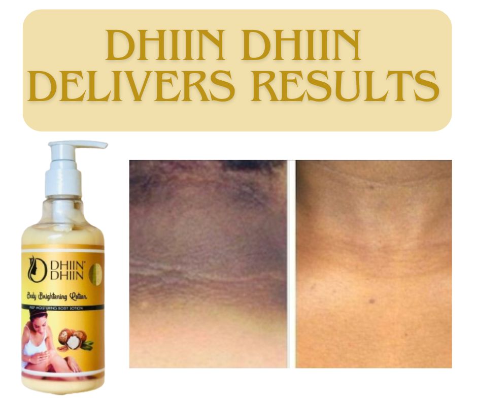Dhiin Dhiin Multi-Area Dark Spot Remover – Smooth & Even Skin All Over