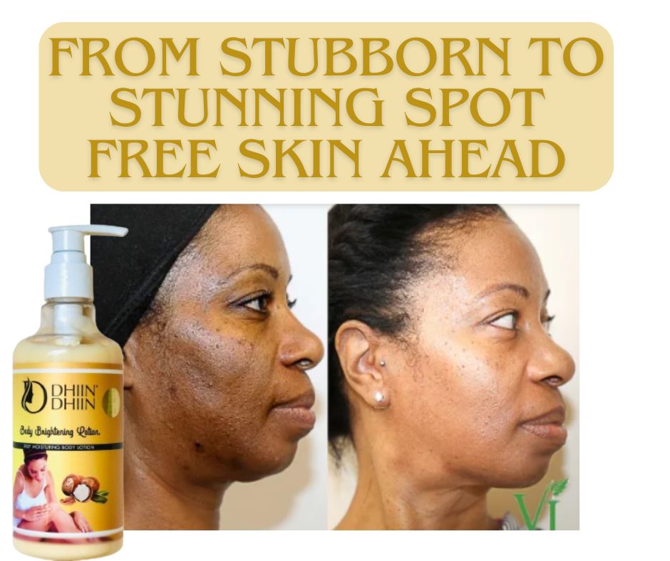 Dhiin Dhiin Multi-Area Dark Spot Remover – Smooth & Even Skin All Over